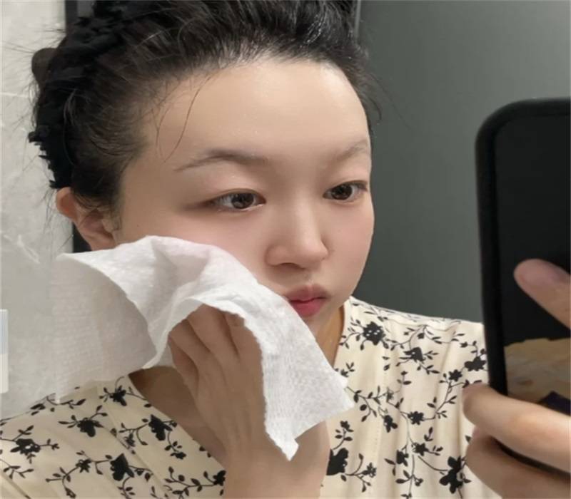 玫瑰痤瘡用什麼卸妝比較好？深層潔淨不緊繃